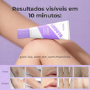 Velure - Creme de Dissolução Capilar Que Dissolve o Pelo Abaixo da Pele e Deixa a Pele Lisa em 10 Minutos (Oferta Exclusiva)