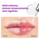 SpiculeShot – Lip Plumper Com Tecnologia Coreana Que Aumenta o Volume e Deixa Efeito Preenchido